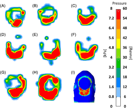 Pressure Regions on the back head 