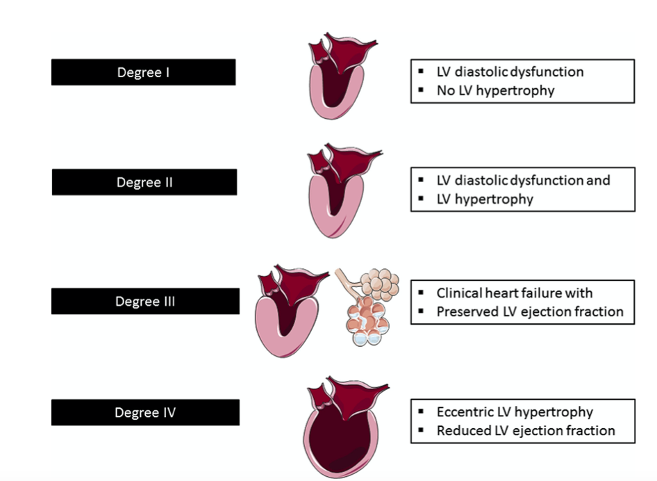 Stages of hypertensive heart disease