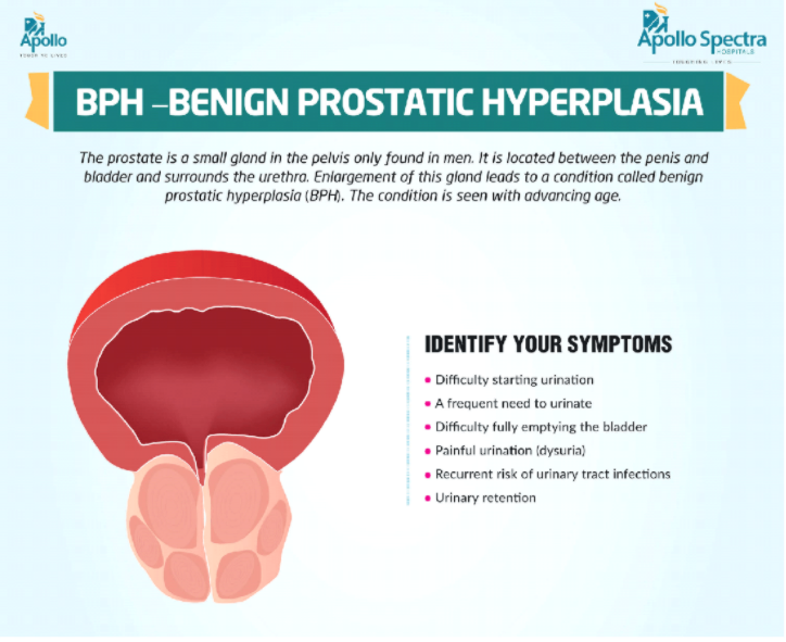 Apollo Spectra Hospital. (n.d.). Enlarged Prostate Treatment and Symptoms. 