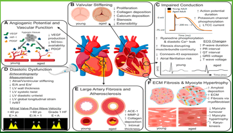 The image above shows age-related remodeling of cardiac tissue