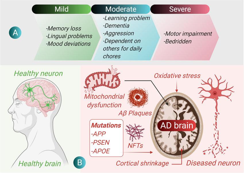 Faiyaz, Maryam, Alzheimer’s disease and its pathogenesis